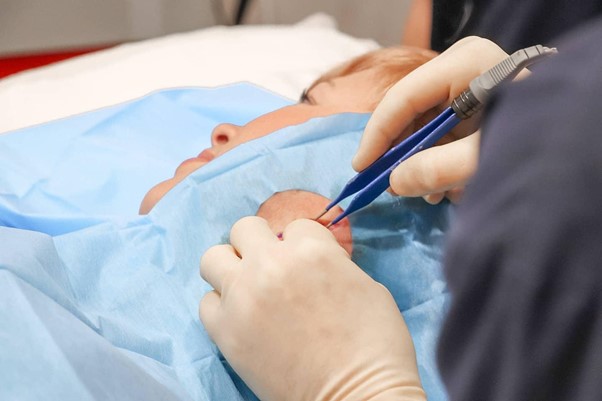 What to Expect with a Cyst Removal Surgery